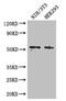 RNA 2',3'-Cyclic Phosphate And 5'-OH Ligase antibody, CSB-PA897546LA01HU, Cusabio, Western Blot image 