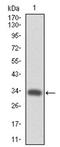 MPL Proto-Oncogene, Thrombopoietin Receptor antibody, AM06740PU-N, Origene, Western Blot image 