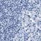 Solute carrier family 45 member 3 antibody, NBP1-89630, Novus Biologicals, Immunohistochemistry paraffin image 
