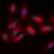 ATP Citrate Lyase antibody, LS-C358894, Lifespan Biosciences, Immunofluorescence image 