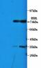BCL2 Like 11 antibody, orb4685, Biorbyt, Western Blot image 