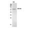 Zinc Finger Protein 384 antibody, A09826, Boster Biological Technology, Western Blot image 