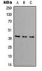 DNA Fragmentation Factor Subunit Beta antibody, LS-C355996, Lifespan Biosciences, Western Blot image 