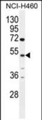 Carboxypeptidase A6 antibody, PA5-71517, Invitrogen Antibodies, Western Blot image 