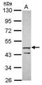 Zinc finger protein 645 antibody, PA5-31534, Invitrogen Antibodies, Western Blot image 