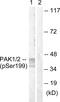 Telomerase Reverse Transcriptase antibody, PA5-38820, Invitrogen Antibodies, Western Blot image 