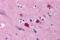 Bcl-2-related ovarian killer protein antibody, MBS150551, MyBioSource, Immunohistochemistry paraffin image 