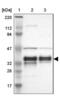 Chromosome 1 Open Reading Frame 198 antibody, NBP1-90519, Novus Biologicals, Western Blot image 