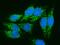 Peptidase, Mitochondrial Processing Alpha Subunit antibody, A09623-1, Boster Biological Technology, Immunofluorescence image 