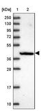 PC-Esterase Domain Containing 1B antibody, PA5-60546, Invitrogen Antibodies, Western Blot image 