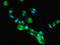 Fc Fragment Of IgG Receptor And Transporter antibody, LS-C285500, Lifespan Biosciences, Immunofluorescence image 
