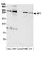 Neurofibromin 1 antibody, A300-140A, Bethyl Labs, Western Blot image 