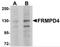 Transmembrane Protein 94 antibody, NBP2-82035, Novus Biologicals, Western Blot image 