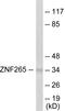 Zinc Finger RANBP2-Type Containing 2 antibody, EKC1659, Boster Biological Technology, Western Blot image 