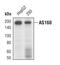 TBC1 Domain Family Member 4 antibody, PA5-17284, Invitrogen Antibodies, Western Blot image 