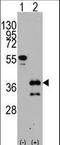 Zinc finger protein ZIC 4 antibody, LS-B9034, Lifespan Biosciences, Western Blot image 