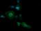 Phosphatidylinositol-4-Phosphate 3-Kinase Catalytic Subunit Type 2 Beta antibody, MA5-26242, Invitrogen Antibodies, Immunocytochemistry image 