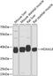 Homeobox protein Hox-A13 antibody, GTX64598, GeneTex, Western Blot image 