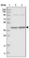 Selenophosphate Synthetase 1 antibody, PA5-58039, Invitrogen Antibodies, Western Blot image 