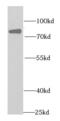 Eukaryotic translation initiation factor 4B antibody, FNab02720, FineTest, Western Blot image 