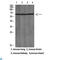 Galectin 3 Binding Protein antibody, LS-C813900, Lifespan Biosciences, Western Blot image 