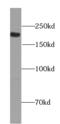 Proprotein Convertase Subtilisin/Kexin Type 5 antibody, FNab06186, FineTest, Western Blot image 