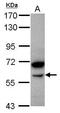 Amylase Alpha 2B (Pancreatic) antibody, PA5-31516, Invitrogen Antibodies, Western Blot image 