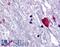 Bombesin Receptor Subtype 3 antibody, LS-A2287, Lifespan Biosciences, Immunohistochemistry paraffin image 