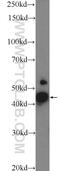 Mitochondrial Calcium Uniporter Regulator 1 antibody, 24948-1-AP, Proteintech Group, Western Blot image 