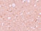 SEC14 And Spectrin Domain Containing 1 antibody, A10698, Boster Biological Technology, Immunohistochemistry frozen image 