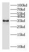 GLYAT antibody, FNab03506, FineTest, Western Blot image 
