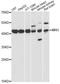 Methylthioribose-1-Phosphate Isomerase 1 antibody, A09725, Boster Biological Technology, Western Blot image 