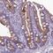 Ankyrin Repeat And Sterile Alpha Motif Domain Containing 4B antibody, HPA043523, Atlas Antibodies, Immunohistochemistry frozen image 