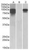 Proprotein Convertase Subtilisin/Kexin Type 9 antibody, AP22408PU-N, Origene, Western Blot image 