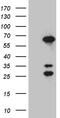 Cornulin antibody, M06991, Boster Biological Technology, Western Blot image 