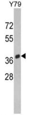 ON antibody, AP17759PU-N, Origene, Western Blot image 