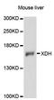 Xanthine Dehydrogenase antibody, LS-C748113, Lifespan Biosciences, Western Blot image 