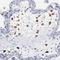 Protein Tyrosine Phosphatase 4A1 antibody, HPA003281, Atlas Antibodies, Immunohistochemistry paraffin image 