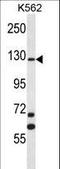 MCF.2 Cell Line Derived Transforming Sequence antibody, LS-C164083, Lifespan Biosciences, Western Blot image 