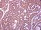 Zwilch Kinetochore Protein antibody, GTX116281, GeneTex, Immunohistochemistry paraffin image 