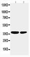Protein Phosphatase 2 Catalytic Subunit Alpha antibody, PA1068, Boster Biological Technology, Western Blot image 