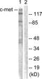 c-met antibody, LS-C117863, Lifespan Biosciences, Western Blot image 