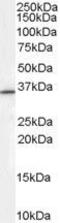 Ring Finger Protein 115 antibody, GTX89285, GeneTex, Western Blot image 