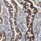 MutY DNA Glycosylase antibody, HPA008732, Atlas Antibodies, Immunohistochemistry frozen image 