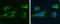 Glutaminase antibody, GTX632265, GeneTex, Immunofluorescence image 