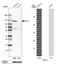 BicC Family RNA Binding Protein 1 antibody, HPA045212, Atlas Antibodies, Western Blot image 