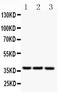 CD79b Molecule antibody, LS-C344028, Lifespan Biosciences, Western Blot image 