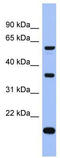 La Ribonucleoprotein Domain Family Member 6 antibody, TA343877, Origene, Western Blot image 