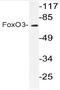 FOXO3A antibody, AP20683PU-N, Origene, Western Blot image 