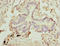 Zinc Finger FYVE-Type Containing 1 antibody, LS-C676740, Lifespan Biosciences, Immunohistochemistry paraffin image 